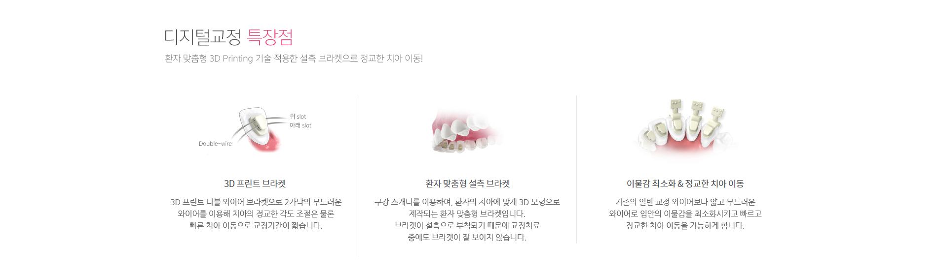 서울라이프치과 디지털 치아교정