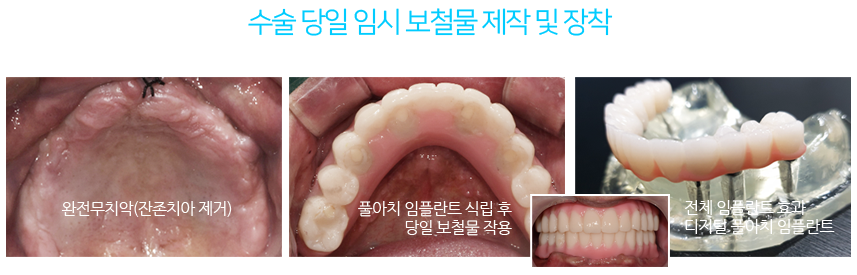 치료보다 예방이 우선입니다.