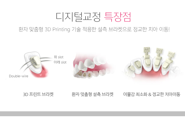 서울라이프치과 교정장치