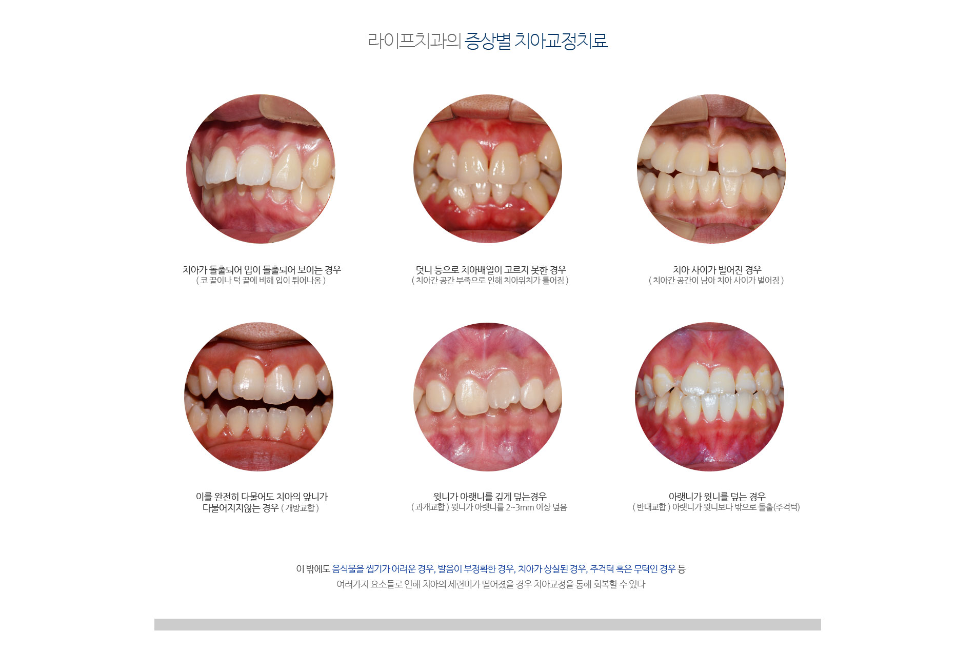 서울라이프치과 치아교정