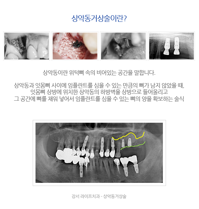 우장산역치과 라이프치과