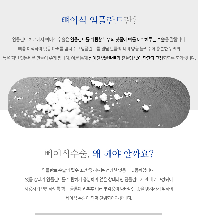 우장산역치과 라이프치과 임플란트 치료과정